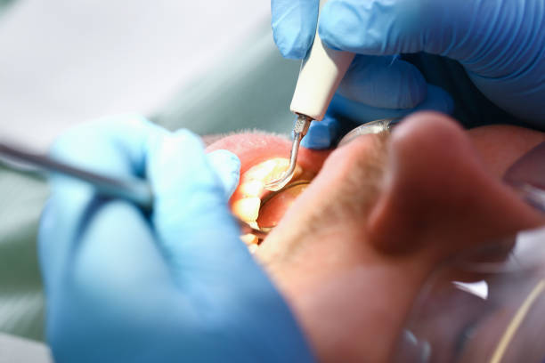 Best Emergency Dental Services for Seniors in Shavertown, PA